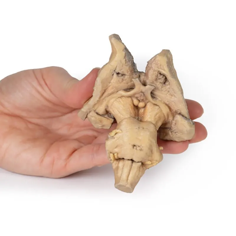 3D Printed Brain Stem, Deep Cerebral and Diencephalic Structures