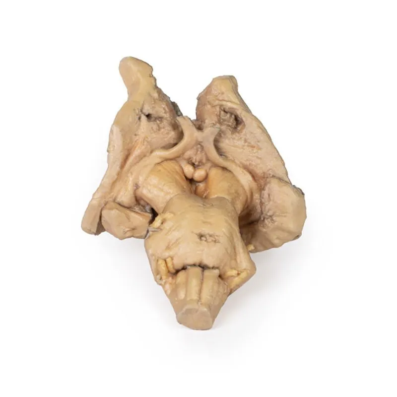 3D Printed Brain Stem, Deep Cerebral and Diencephalic Structures