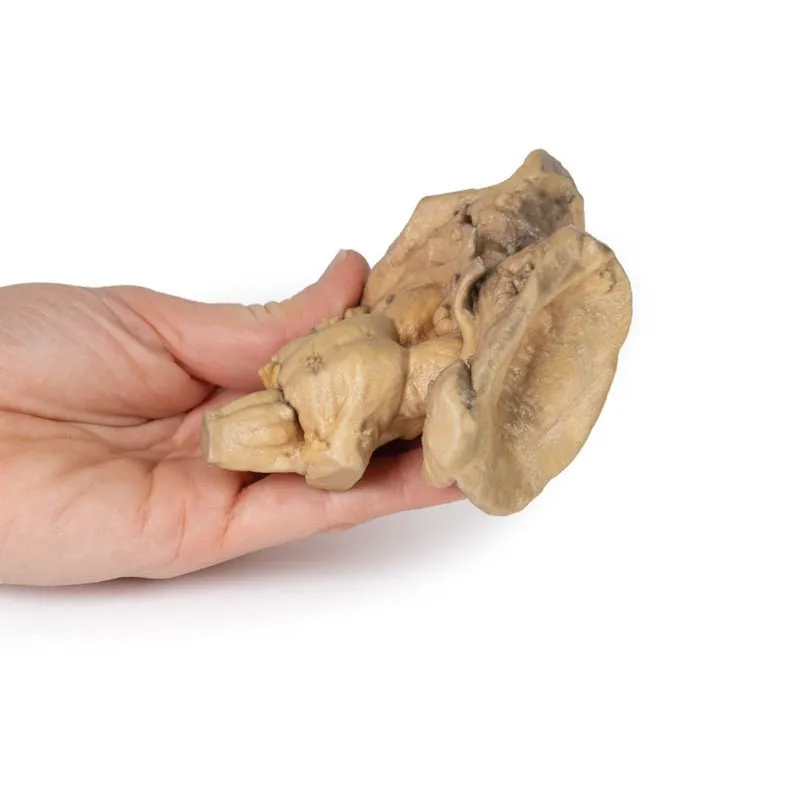 3D Printed Brain Stem, Deep Cerebral and Diencephalic Structures