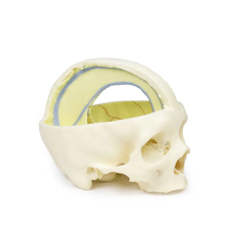 3D Printed Dural Skull Model