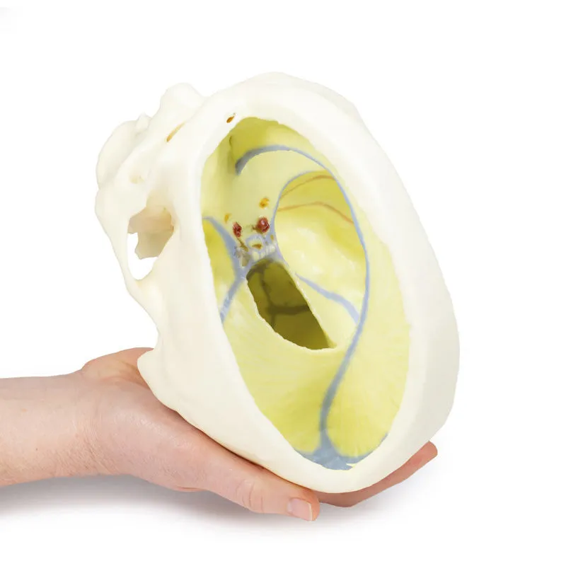 3D Printed Dural Skull Model