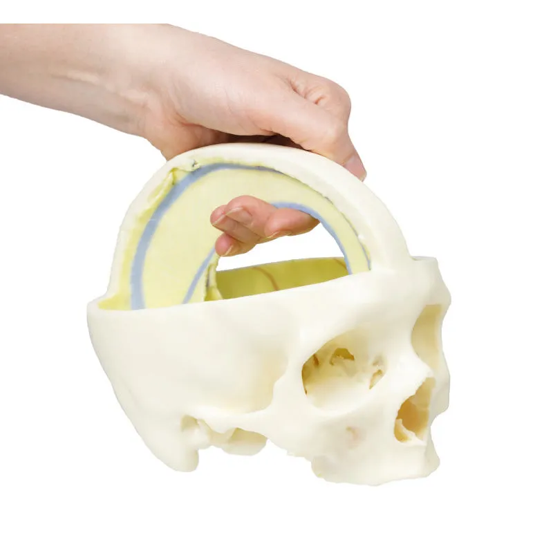 3D Printed Dural Skull Model