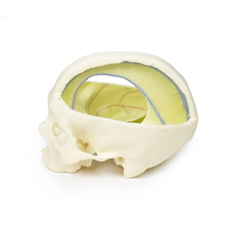 3D Printed Dural Skull Model