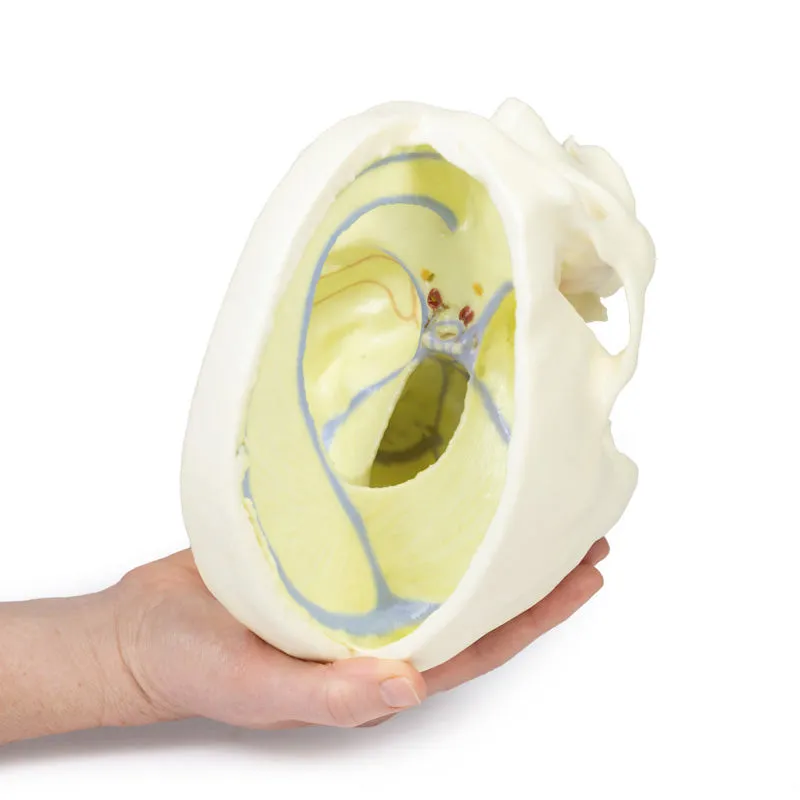 3D Printed Dural Skull Model